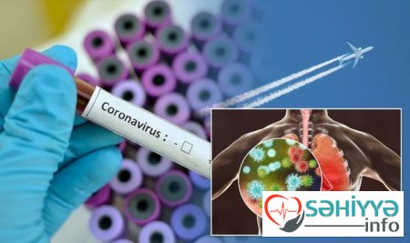 Koronavirusu yüngül keçirməyimizin daha bir səbəbi bu imiş... - Azərbaycanlı həkim elmi yeniliyi AÇIQLADI - FOTO
