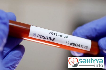 Koronavirus peyvəndi ilə bağlı ŞAD XƏBƏR