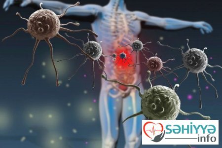 Cərrah XƏRÇƏNG xəstəliyi haqqında vacib SİRLƏRİ AÇDI - MÜSAHİBƏ Xüsusi16 Dekabr 2019 09:003 901 Baxış Cərrah XƏRÇƏNG xəstəliyi haqqında vacib SİRLƏRİ AÇDI - MÜSAHİBƏ Xüsusi16 Dekabr 2019 09:003 901 Baxış