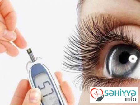 Diabetik retinopatiya ağır göz xəstəliyidir