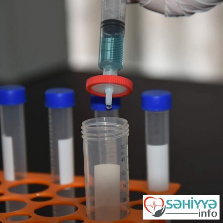 Koronavirus əleyhinə zərdab ixtira edildi