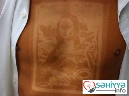 Gülməli günəş yanıqları - Fotolar Gülməli günəş yanıqları - Fotolar