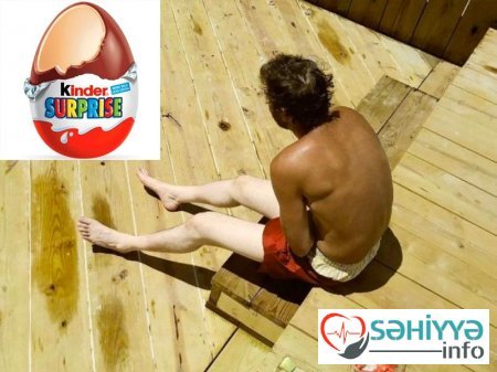 Gülməli günəş yanıqları - Fotolar Gülməli günəş yanıqları - Fotolar