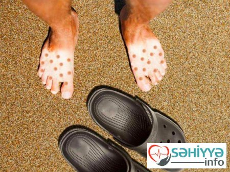 Gülməli günəş yanıqları - Fotolar Gülməli günəş yanıqları - Fotolar