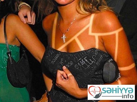 Gülməli günəş yanıqları - Fotolar Gülməli günəş yanıqları - Fotolar