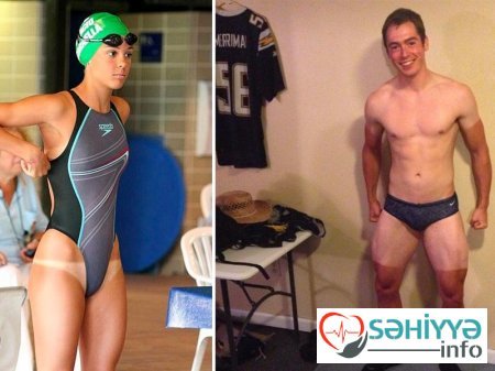 Gülməli günəş yanıqları - Fotolar Gülməli günəş yanıqları - Fotolar