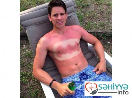 Gülməli günəş yanıqları - Fotolar Gülməli günəş yanıqları - Fotolar