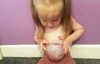 Mədəsi və ciyəri çöldə doğulan qız - 2 yaşı var (FOTO)