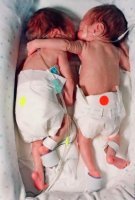 Bacısını qucaqladı,həmən vəziyyəti stabilləşdi.