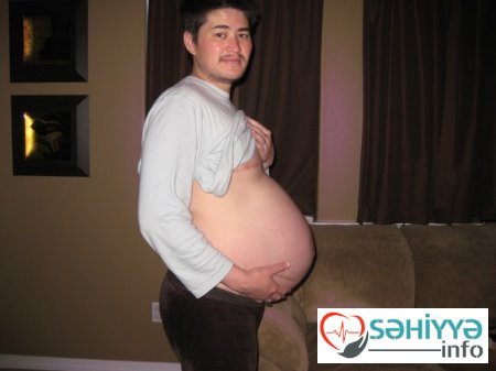 Azərbaycanda kişiyə hamilə diaqnozu qoyuldu - FOTOFAKT