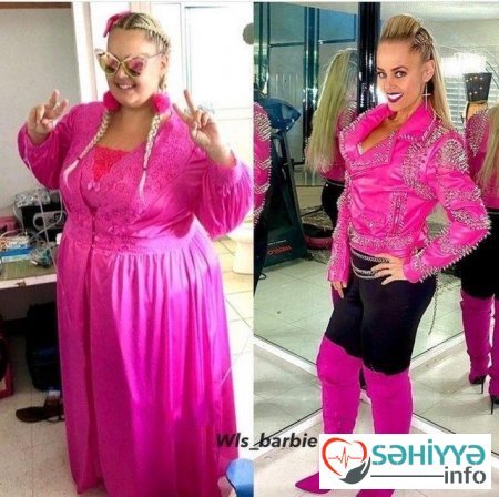 Barbiyə bənzəmək üçün 90 kq arıqladı – FOTOLAR