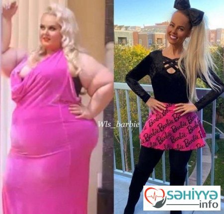 Barbiyə bənzəmək üçün 90 kq arıqladı – FOTOLAR