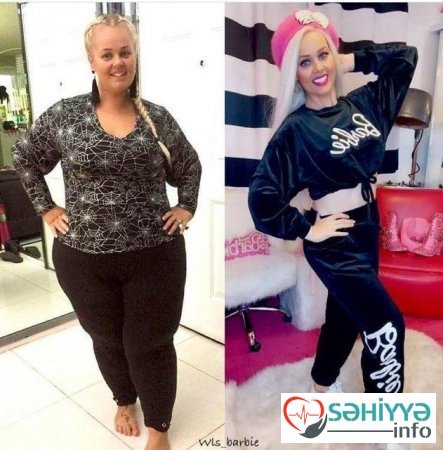 Barbiyə bənzəmək üçün 90 kq arıqladı – FOTOLAR