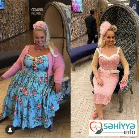 Barbiyə bənzəmək üçün 90 kq arıqladı – FOTOLAR