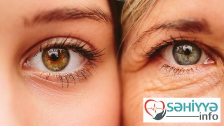 Bu qidalar dərinin qırışmasına yol açır