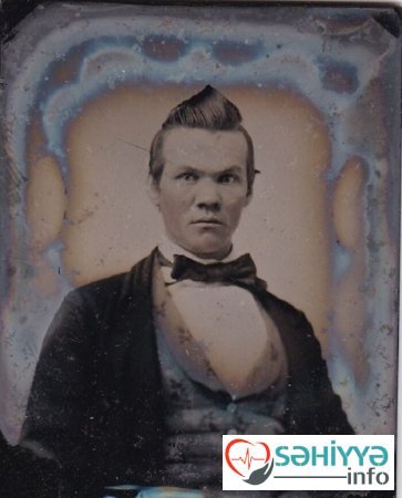 Keçmişdə məşhur olan qəribə və gülməli SAÇ DÜZÜMLƏRİ - FOTOLENT