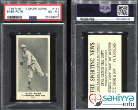 Həkimin uşaqlıq hobbisi ailəsini milyonçu etdi - FOTO