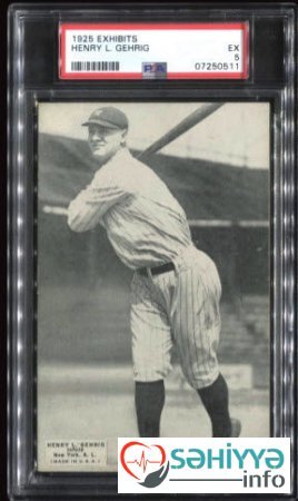 Həkimin uşaqlıq hobbisi ailəsini milyonçu etdi - FOTO