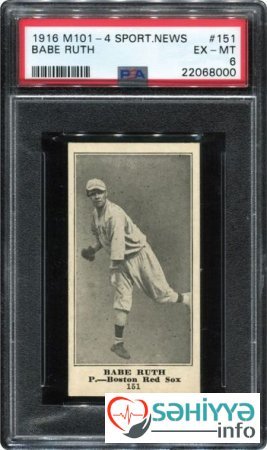 Həkimin uşaqlıq hobbisi ailəsini milyonçu etdi - FOTO