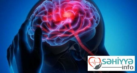 COVID-19 beynimizi necə məhv edir? - Nevroloq ŞOK NƏTİCƏLƏRİ açıqladı