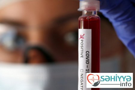 İnsanlar 14 gün evdə qalmamaq üçün bunu edirlər, amma... - Koronavirus HİYLƏSİ