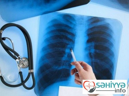 Həkimdən XƏBƏRDARLIQ: Uşaqlarınızı tez-tez rentgen etdirməyin, yoxsa....