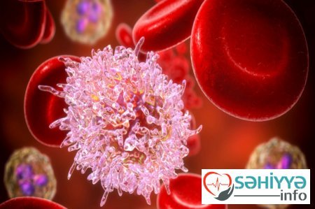 Qan xərçənginə yoluxmanın SƏBƏBİ