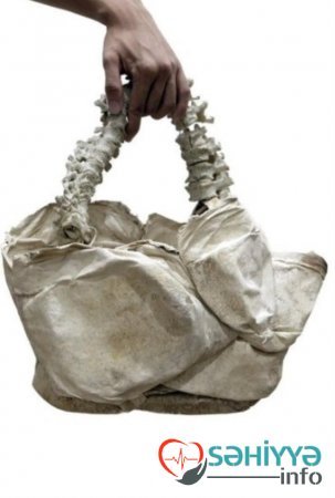 İnsan orqanlarından çanta hazırlayan məşhur modelyer SAXLANILDI - Polisin ələ keçirdiyi qutudan nələr çıxdı? (FOTOLAR) İnsan orqanlarından çanta hazırlayan məşhur modelyer SAXLANILDI - Polisin ələ keçirdiyi qutudan nələr çıxdı? (FOTOLAR)