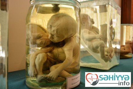 Torpaq qismət olmayanların qəbristanlığı - Bakının ən qorxulu muzeyindən FOTOLAR