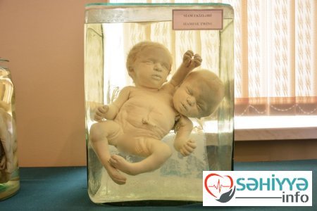 Torpaq qismət olmayanların qəbristanlığı - Bakının ən qorxulu muzeyindən FOTOLAR Torpaq qismət olmayanların qəbristanlığı - Bakının ən qorxulu muzeyindən FOTOLAR