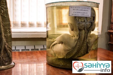 Torpaq qismət olmayanların qəbristanlığı - Bakının ən qorxulu muzeyindən FOTOLAR Torpaq qismət olmayanların qəbristanlığı - Bakının ən qorxulu muzeyindən FOTOLAR