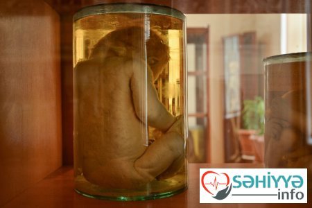 Torpaq qismət olmayanların qəbristanlığı - Bakının ən qorxulu muzeyindən FOTOLAR Torpaq qismət olmayanların qəbristanlığı - Bakının ən qorxulu muzeyindən FOTOLAR