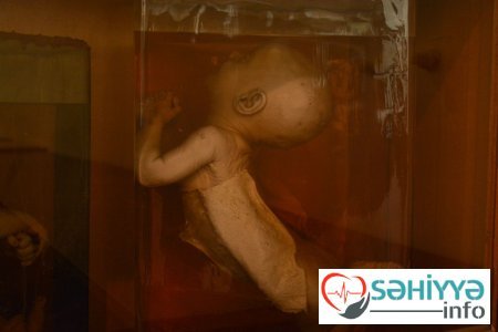 Torpaq qismət olmayanların qəbristanlığı - Bakının ən qorxulu muzeyindən FOTOLAR Torpaq qismət olmayanların qəbristanlığı - Bakının ən qorxulu muzeyindən FOTOLAR