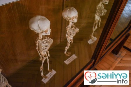 Torpaq qismət olmayanların qəbristanlığı - Bakının ən qorxulu muzeyindən FOTOLAR Torpaq qismət olmayanların qəbristanlığı - Bakının ən qorxulu muzeyindən FOTOLAR