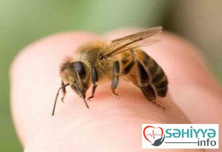 Arı sancması hansı halda ölümə səbəb ola bilər?