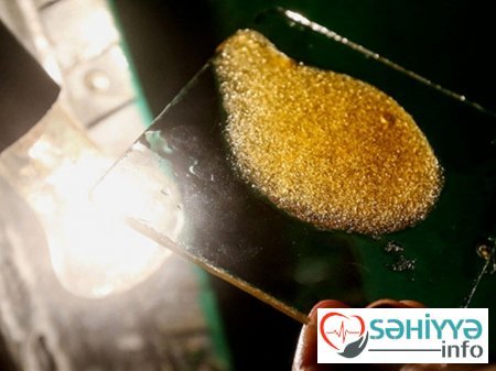 Şəkərin zərəri izah edilib