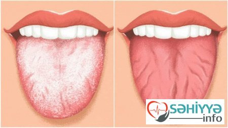 Dildəki ərp nədən xəbər verir?