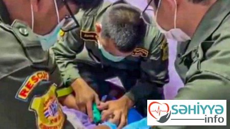 Cinsiyyət orqanındakı ağrılara görə xəstəxanaya getdi - Həkim yanğınsöndürənləri çağırdı (FOTO)