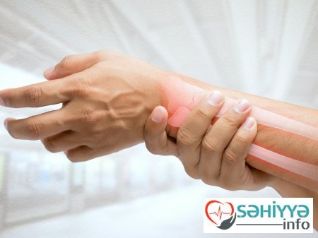 Əllərin uyuşma səbəbləri