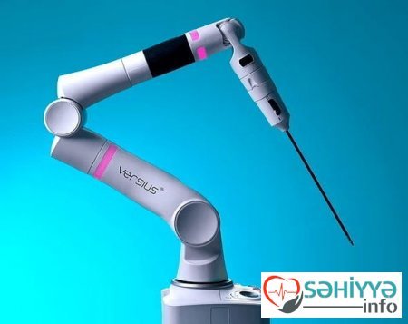 Robot ilk dəfə xərçəng əməliyyatı apardı, nəticə möhtəşəm oldu - FOTO Robot ilk dəfə xərçəng əməliyyatı apardı, nəticə möhtəşəm oldu - FOTO