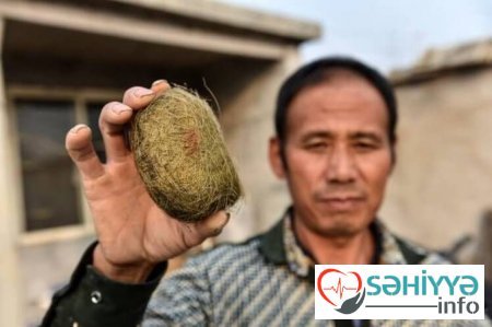 Qızıl qiymətinə öd daşları - Azərbaycanda dananın öd daşı 100 manatdır? - Araşdırma