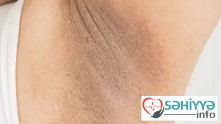 Nə soda, nə də limon... - Qoltuqaltı qaralmaları unudun