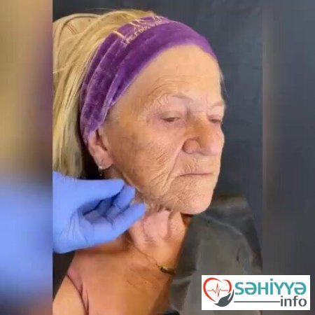 70 yaşlı qadının estetikli halı hamını şoka saldı