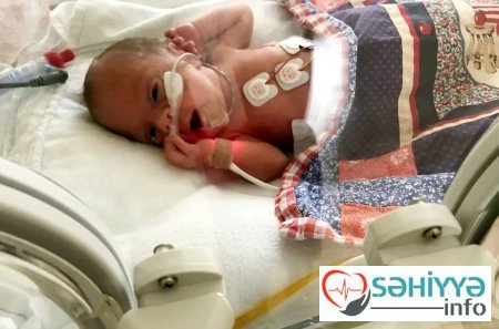 Körpə ana bətnində onurğa beynindən əməliyyat olundu - indi qızcığaz nəinki hərəkət edir, həm də qaça bilir...