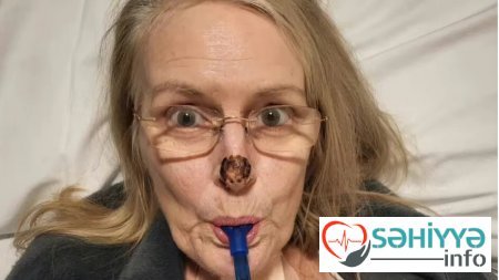 Qadın ət yeyən bakteriyadan belə xilas oldu