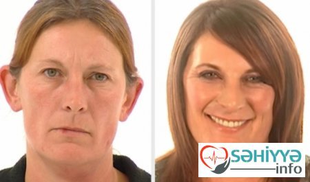 Plastik əməliyyatın dəyişdiyi 10 qadın Plastik əməliyyatın dəyişdiyi 10 qadın