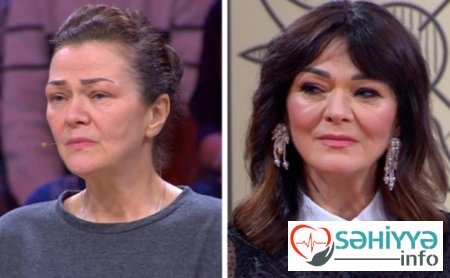 Plastik əməliyyatın dəyişdiyi 10 qadın Plastik əməliyyatın dəyişdiyi 10 qadın