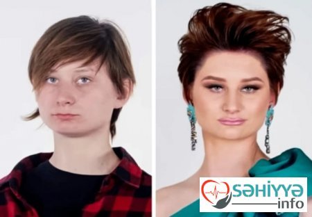 Plastik əməliyyatın dəyişdiyi 10 qadın Plastik əməliyyatın dəyişdiyi 10 qadın