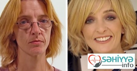 Plastik əməliyyatın dəyişdiyi 10 qadın Plastik əməliyyatın dəyişdiyi 10 qadın