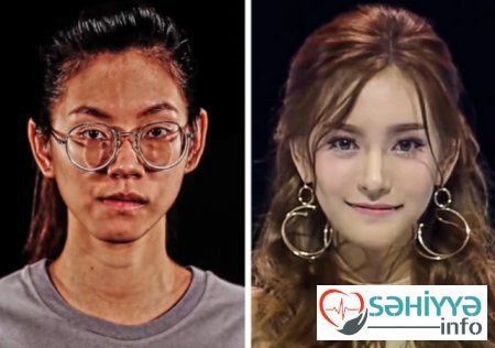 Plastik əməliyyatın dəyişdiyi 10 qadın Plastik əməliyyatın dəyişdiyi 10 qadın